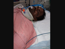 Help Murahari Recover From An Accident