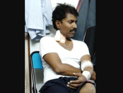 Help Sudhakar Undergo Kidney Transplant