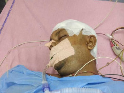 Help My Friend Undergo A Head Surgery