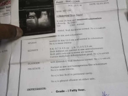Help Me To Get Treated For Liver Treatment
