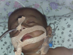 Help 6 Month Old Bikshapathi Fight with Pneumonia