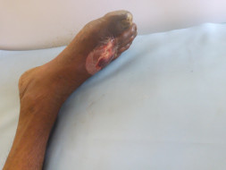 kidney failure Help My Father Get Treated