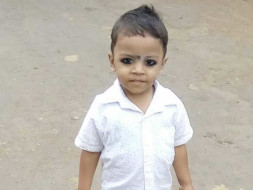 Help Baby Jagdish Undergo Cochlear Implantation Surgery