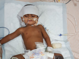 This 1-Year-Old’s Hands And Legs Will Be Amputated Because Of Gangrene