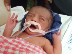 Help 1-day-old Baby Recover From Respiratory Issues