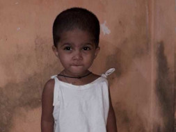 Help My Daughter Undergo Heart Surgery