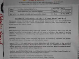 Support My Mother's Umbilical Hernia Treatment