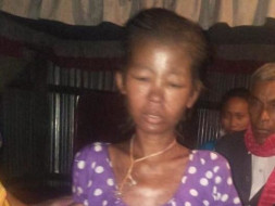 Help Pinki Recover from Kidney failure