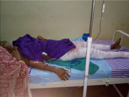 Help A Poor Burn Victim Recover