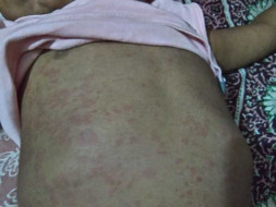 Ehan needs your help to undergo his treatment
