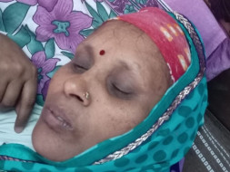Help My Mother For Her Breast Cancer Treatment