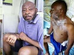 Help Prince James Peters fight Kidney Failure