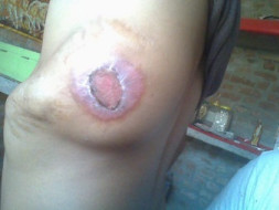 Help My Son Pankaj Get Treatment This Fund Raising For Kidney Fongtion