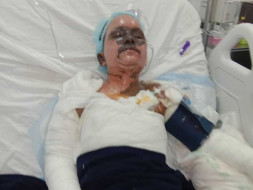 Help My Mother To Recover