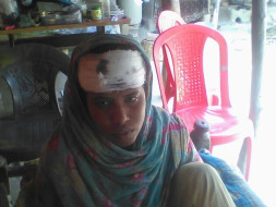 Multiple Injuries on the Head