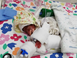 Save My Daughter Who is Admitted In NICU