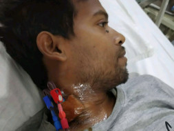 Help Anukar Undergo Kidney Transplant