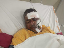Help Mallari save him from brain injury