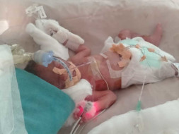 Help Critical Pre term Twin babies in NICU