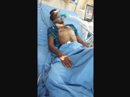 Help Ravi Fight ARDS