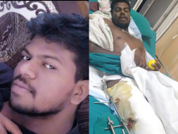 Help Loganathan to get treated