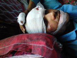 Help Sumit To recover from several injuries.Its very urgent
