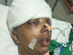 Help Mahesh Recover From A Major Accident