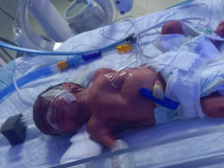Please Save A Premature Baby, Now Struggling For Life In ICU!