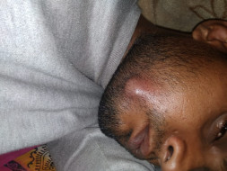 Help Prabhakar Fight Mouth Cancer