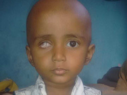 Help Divya Fight Eye Cancer