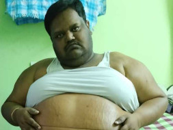 Help Naveen Goud With Morbid Obesity Stomach Filled With Water