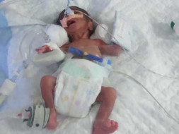 Help Us Save Our Premature Baby