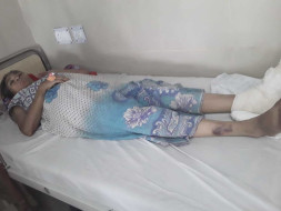 Help my Colleague Usha undergo Foot Surgery