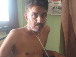 Help Me Undergo A Lung Transplant
