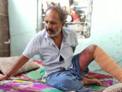 After a Bus Ran Over Man's Leg, His Family Was Brought To The Streets