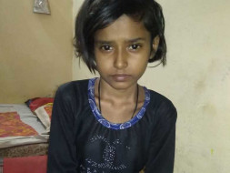 Muskan Is Dying Of CVJ Pott's Disease. Can You Help?