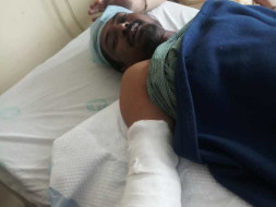 Help Mahmood Shaikh to get Prosthetic hand