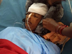 Help Narsavva Undergo A Brain Surgery