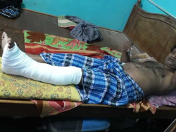 Help My Dad Recover From An Accident