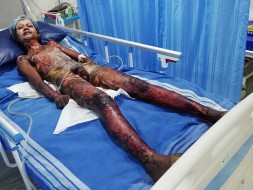 Help Shaik Recover From Serious Burns