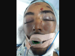 Help Mohamed Zabi Recover From An Accident