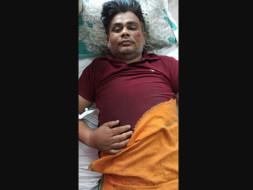 Help Vijay Recover From An Accident