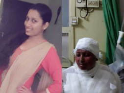 Help Ms.Pavithra recover from a rare Skin disorder Pemphigus Vulgaris