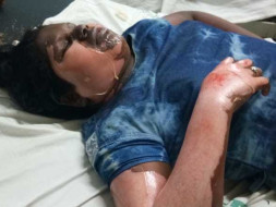 Support Harshitha Recover From An Accident
