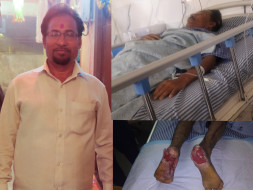 Help to raise fund for my father's both heels plastic surgery