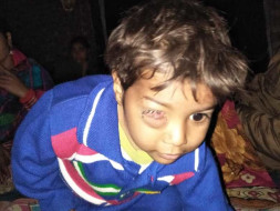 Support 2 Year Old Mohd. Saad Fighting With Cell Tumor On His Eye
