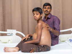 Help Ganesh Fight Decomposed Chronic Liver Disease