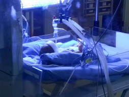 Help my premature baby