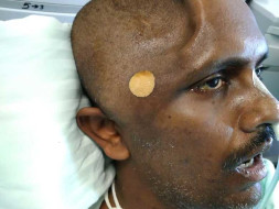 Help Mahesh Recover From A major Accident