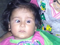 Please help Baby with squint eyes!